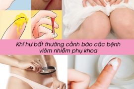 bat-benh-phu-khoa-qua-tinh-chat-mau-sac-cua-khi-hu