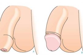 cat-bao-quy-dau-la-gi